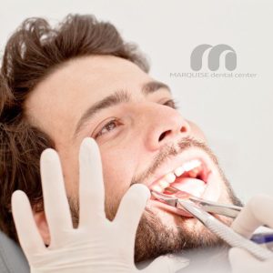 جراحی و کشیدن دندان در غرب تهران در محیط لوکس کلینیک دندانپزشکی مارکیز