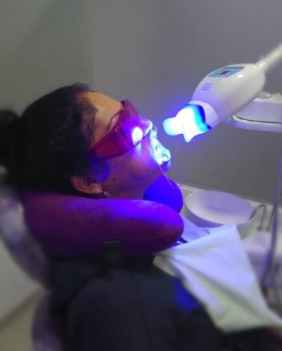 دندانپزشک در حال انجام بلیچینگ دندان با تجهیزات مدرن در کلینیک مارکیز